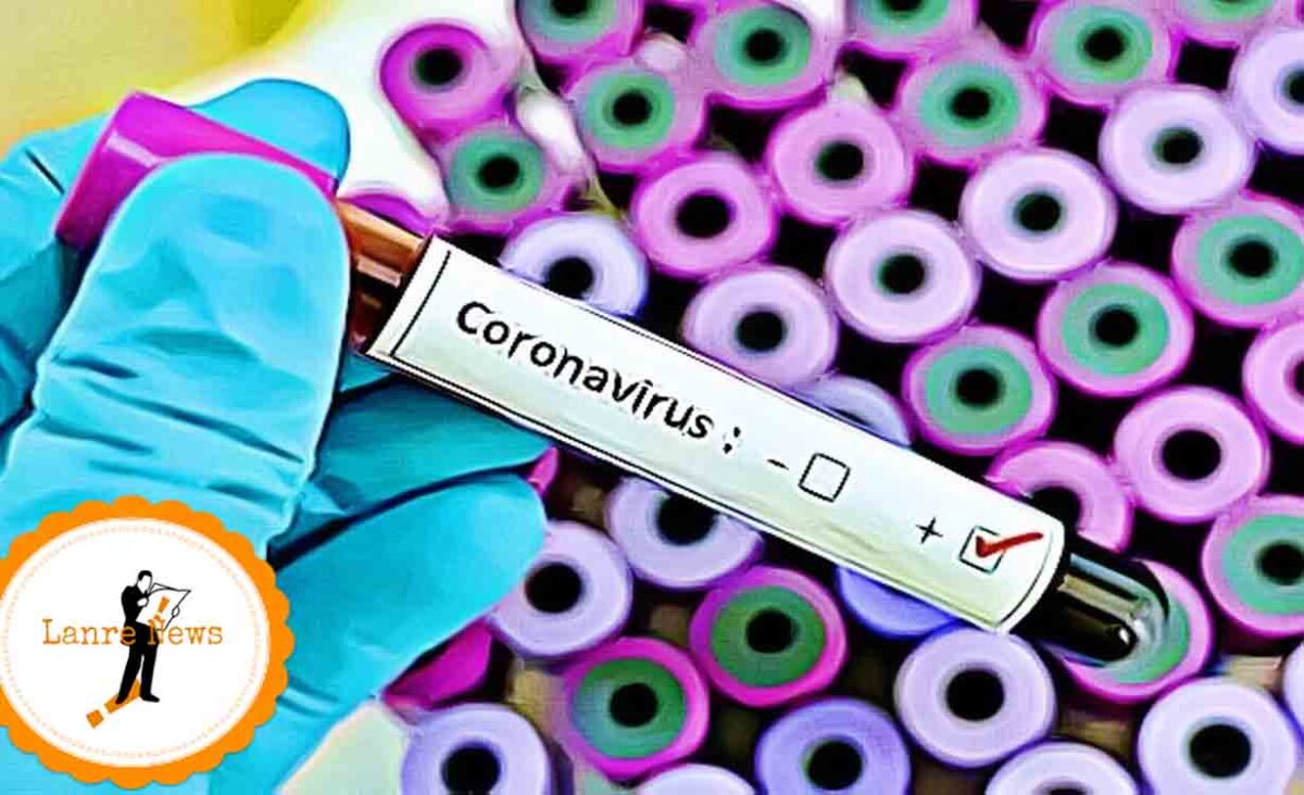 Coronavirus: Yobe Govt. Confirms Suspected Case Negative